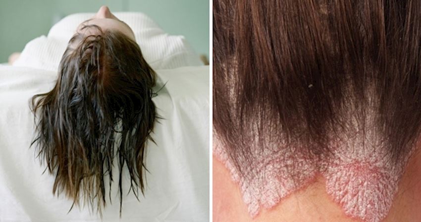 湿头发睡觉有什么危害?
